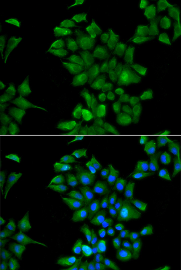 Immunofluorescence analysis of HeLa cells using CTNS antibody 