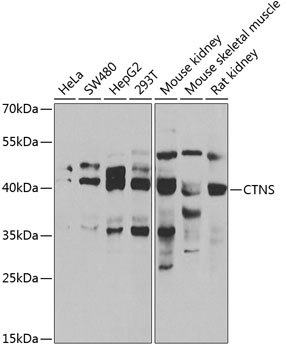 Western blot analysis of extracts of various cell lines, using CTNS antibody  at 1:1000 dilution
