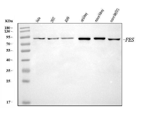  Western blot analysis of FES using anti-FES antibody (A01453-2)
