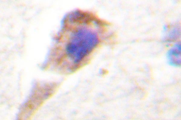 a01455 prkd1 primary antiboties ihc testing 2