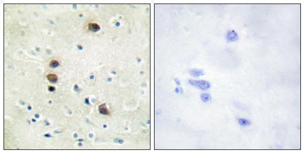 a01455s205 1 prkd1 primary antibodies ihc testing 4