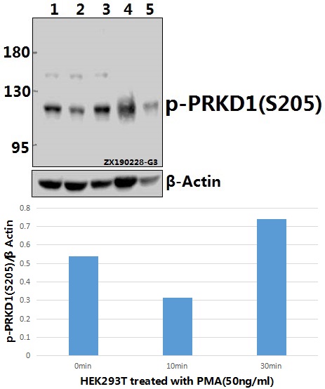 a01455s205 prkd1 primary antiboties wb testing 1