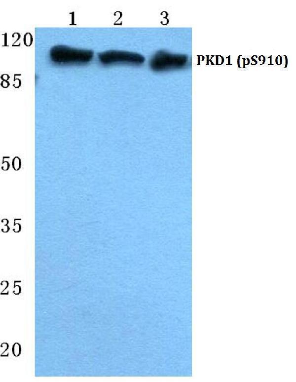 a01455s910 prkd1 primary antiboties wb testing 1