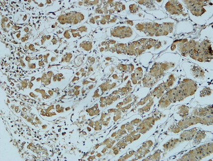 Immunohistochemical analysis of paraffin-embedded Human colon