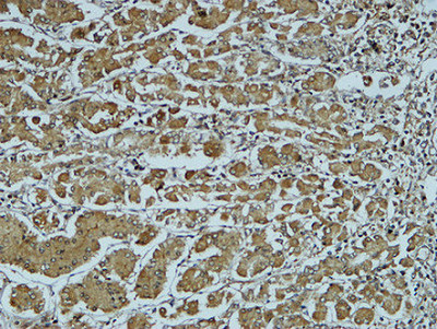 a01456 1 ctsb primary antibodies ihc testing 5