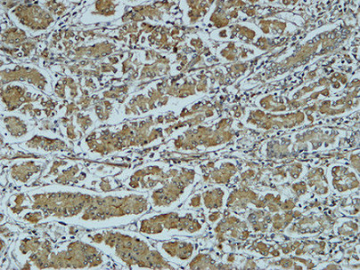 a01456 1 ctsb primary antibodies ihc testing 6