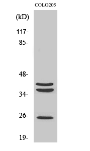 Western Blot analysis of various cells using Cathepsin B Polyclonal Antibody