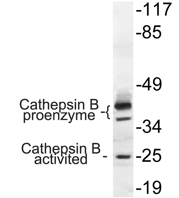 Western blot analysis of lysate from COLO cells, using Cathepsin B antibody