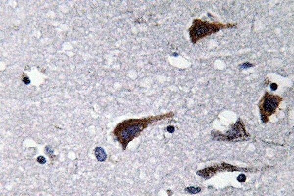 Immunohistochemistry (IHC) analyzes of Cathepsin B (N217) pAb in paraffin-embedded human brain tissue