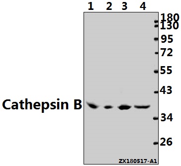 Western blot (WB) analysis of Cathepsin B (N217) pAb at 1:2000 dilution
Lane1:The Embryo tissue lysate of Mouse(40ug)
Lane2:The Lung tissue lysate of Rat(40ug)
Lane3:HCT116 whole cell lysate(40ug)
Lane4:A549 whole cell lysate(40ug)