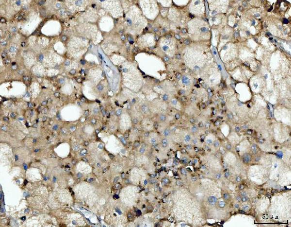  IHC analysis of Cathepsin B/CTSB using anti-Cathepsin B/CTSB antibody (A01456-3)