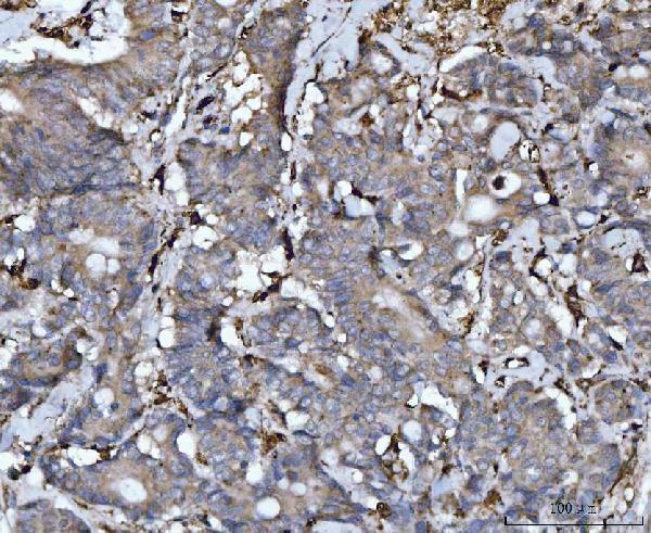  IHC analysis of Cathepsin B/CTSB using anti-Cathepsin B/CTSB antibody (A01456-3)