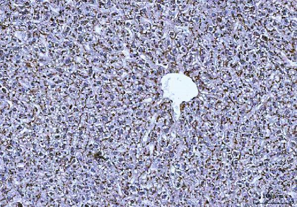 a01456 3 ctsb primary antibodies ihc testing 5