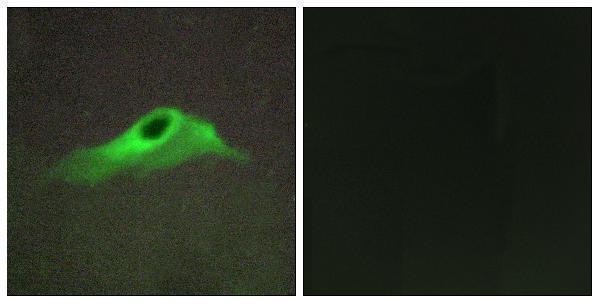 Immunofluorescence analysis of HeLa cells, using Collagen IV alpha5 Antibody