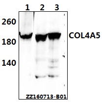 Western blot (WB) analysis of COL4A5 polyclonal antibody at 1:500 dilution
Lane1:A549 whole cell lysate(40ug)
Lane2:786-O whole cell lysate(40ug)
Lane3:HEK293T whole cell lysate(40ug)