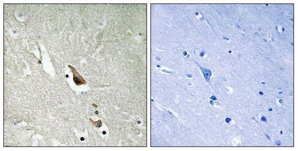 Immunohistochemistry analysis of paraffin-embedded human brain, using MAP3K7 (Phospho-Ser439) Antibody