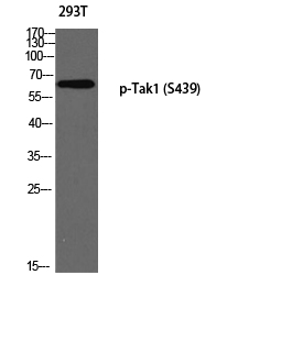 Western blot analysis of 293T using p-Tak1 (S439) antibody