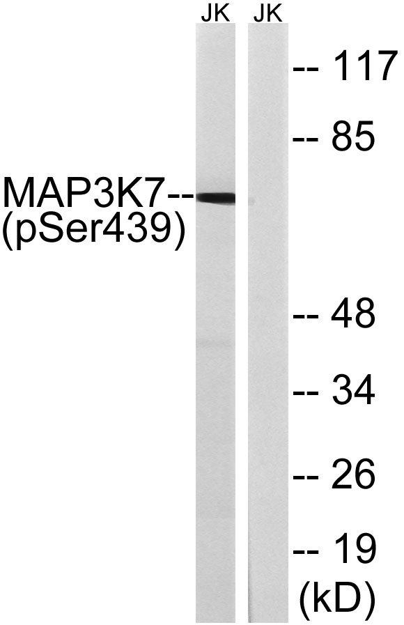 Western blot analysis of lysates from Jurkat cells treated with PMA 125ng/ml 30