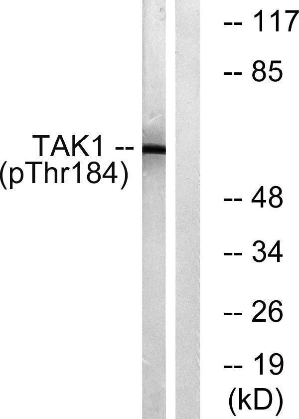 Western blot analysis of lysates from HepG2 cells treated with TNF 20ng/ml 5', using TAK1 (Phospho-Thr184) Antibody