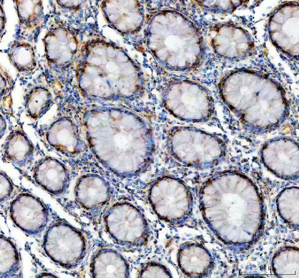  IHC analysis of GALT using anti-GALT antibody (A01460-1)