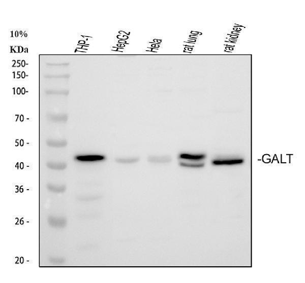  Western blot analysis of GALT using anti-GALT antibody (A01460-1)