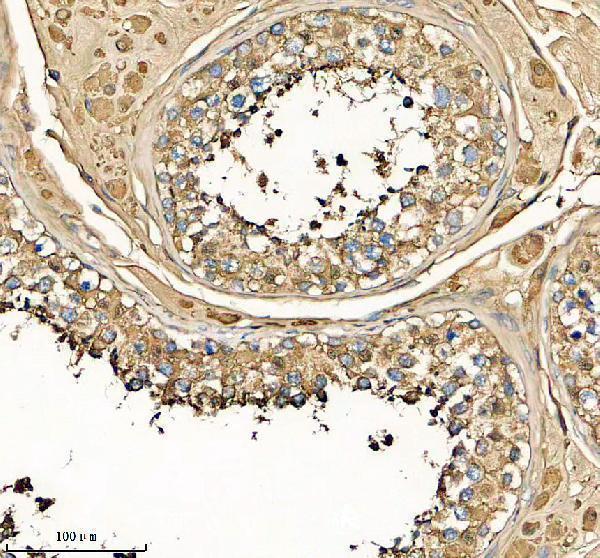 IHC analysis of GSTA1 using anti-GSTA1 antibody (A01462-3)