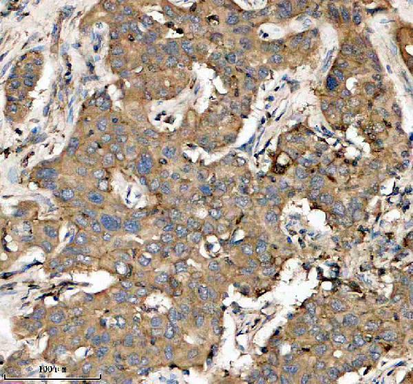 IHC analysis of GSTA1 using anti-GSTA1 antibody (A01462-3)