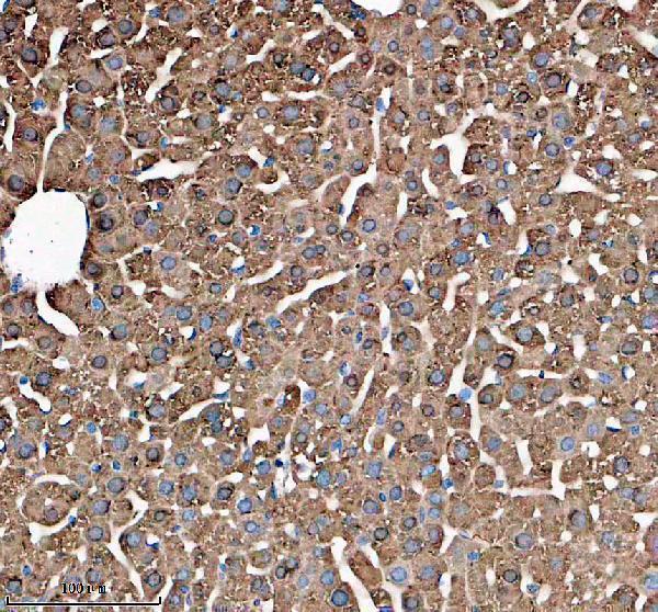 IHC analysis of GSTA1 using anti-GSTA1 antibody (A01462-3)