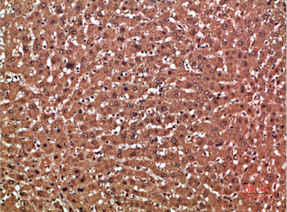 a01462 gsta1 primary antibodies ihc testing 1