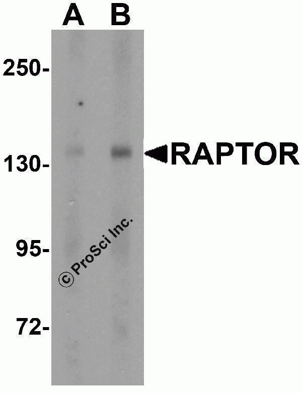 a01463 1 rptor primary antibodies wb testing 1