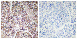 a01466 1 gdf9 primary antibodyes ihc testing 2