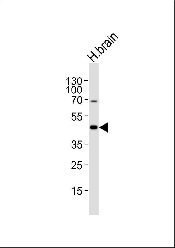 a01467 1 anti htr1a antibody center wb testing 1