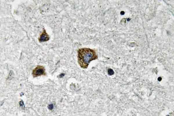 a01469 1 bnip3 primary antiboties ihc testing 2