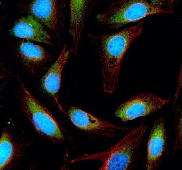 IF analysis of ESD using anti-ESD antibody (A01471-1) and anti-Beta Tubulin antibody (M01857-3)