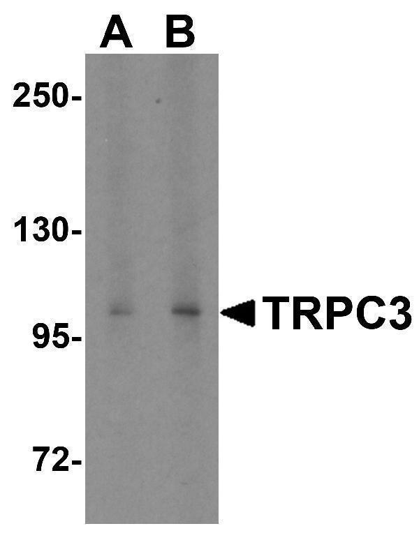 a01472 1 trpc3 primary antibodies wb testing 1