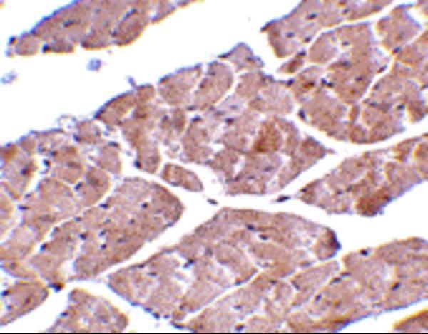 Immunohistochemistry of TRPC3 in mouse heart tissue with TRPC3 antibody at 2 μg/mL