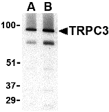 Western blot analysis of TRPC3 in human brain tissue lysate with TRPC3 antibody at (A) 1 and (B) 2 μg/mL
