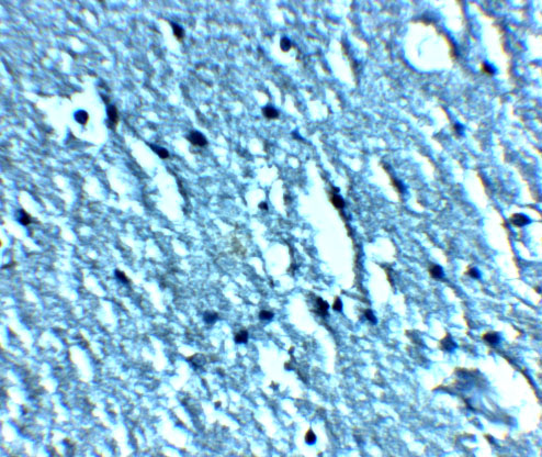 Immunohistochemistry of TRPC3 in human brain tissue with TRPC3 antibody at 2