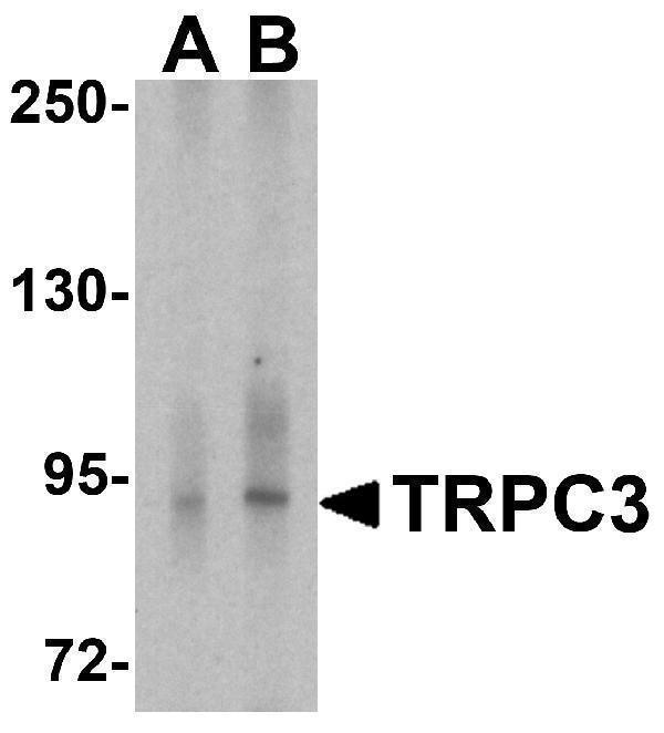 Western blot analysis of TRPC3 in human cerebellum tissue lysate with TRPC3 antibody at (A) 1 and (B) 2 μg/ml
