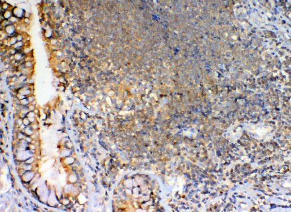 a01473 1 grk2 primary antibodies ihc testing 2