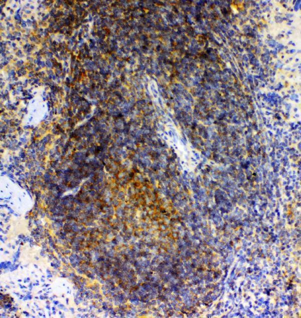 a01473 1 grk2 primary antibodies ihc testing 3