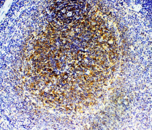 a01473 1 grk2 primary antibodies ihc testing 4