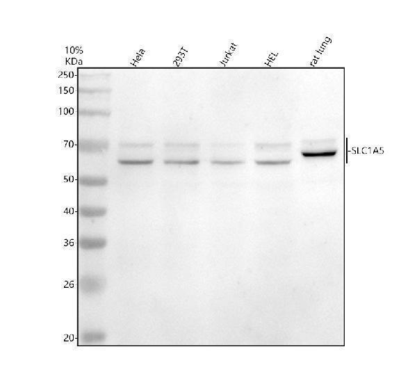 a01474 1 slc1a5 primary antibodies wb testing 1