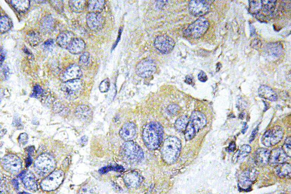 a01475s411 rps6kb1 primary antiboties ihc testing 2