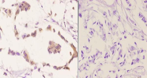 a01475s418 1 rps6kb1 primary antiboties ihc testing 2