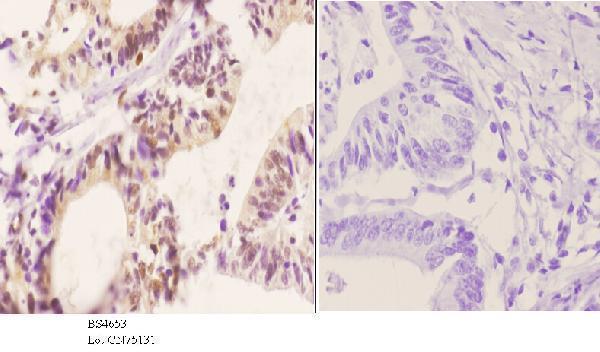 a01475s418 1 rps6kb1 primary antiboties ihc testing 3