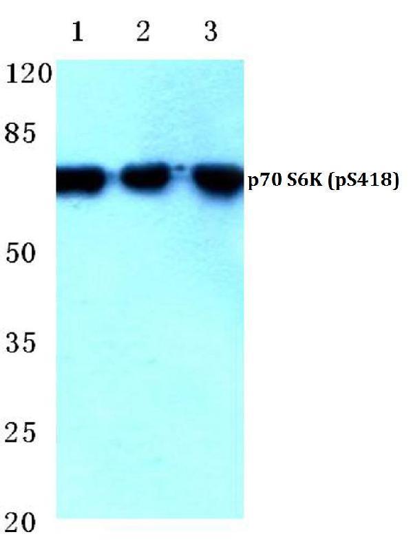 a01475s418 1 rps6kb1 primary antiboties wb testing 1