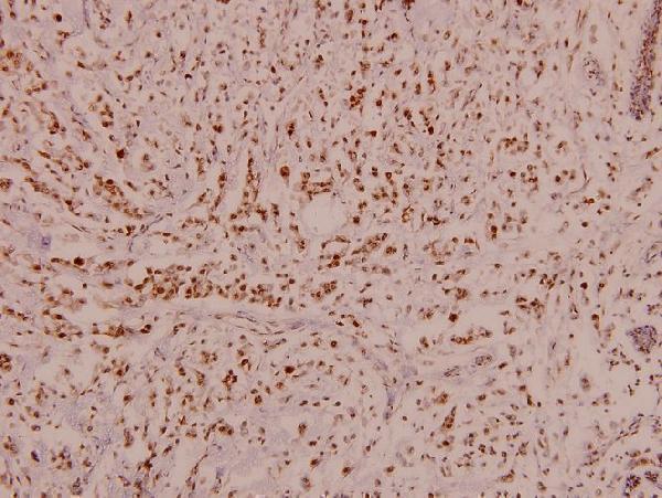 a01475s424 rps6kb1 primary antiboties ihc testing 2