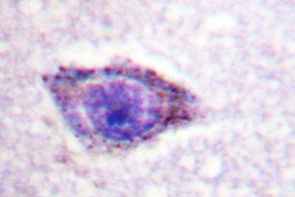 a01475t229 rps6kb1 primary antiboties ihc testing 2