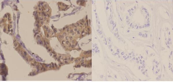 a01475t421 rps6kb1 primary antiboties ihc testing 2